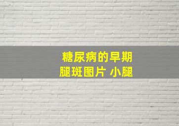 糖尿病的早期腿斑图片 小腿